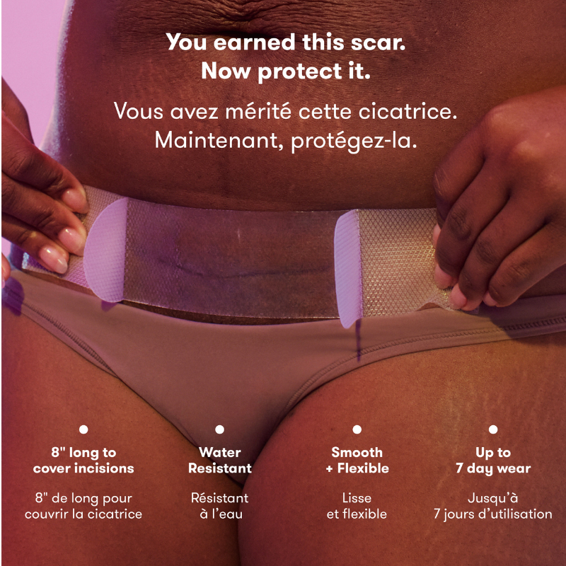 Patchs de cicatrice de césarienne