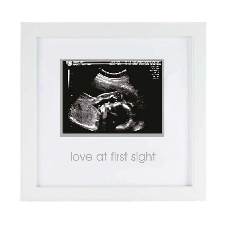 Sonogram Frame